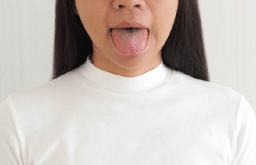what causes dry mouth