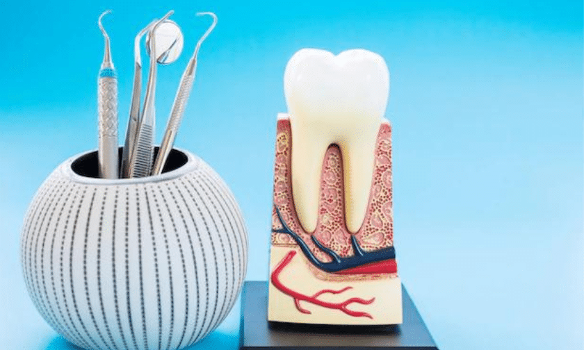 How Long Does the Root Canal Process Take?