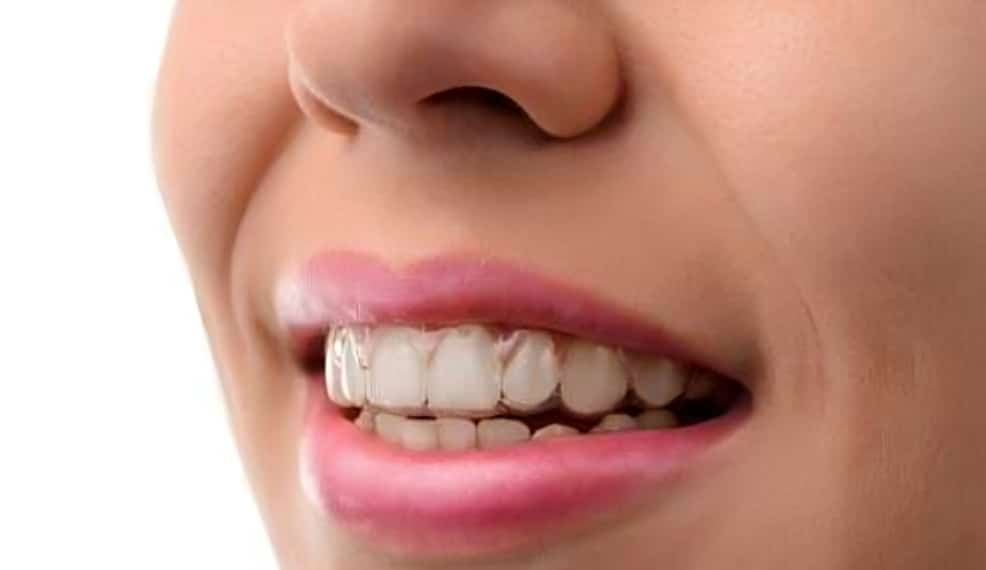 Close-up of person smiling, displaying healthy white teeth and pink lips against white background.