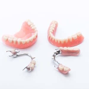 Dentures and dental clasps displayed on white surface showing removable prosthetic teeth options.