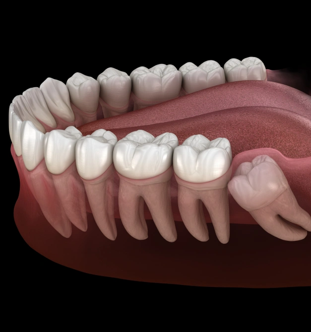 3D dental illustration showing upper and lower teeth anatomy with gum structure and tooth roots.